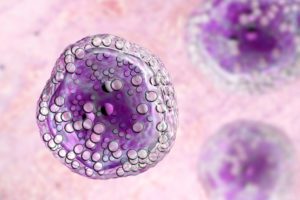 Burkitt's lymphoma cells Steven Kussick